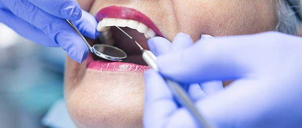 Best Emergency Dental Care for Broken or Chipped Teeth in Spring Lake, MI