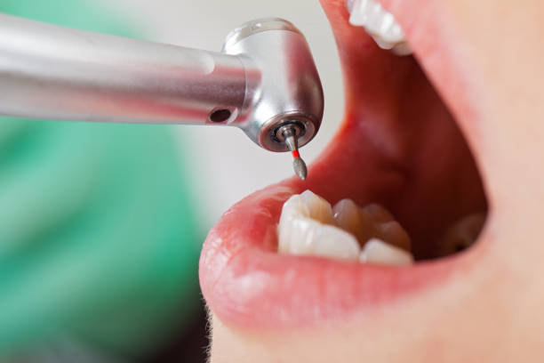 Best Emergency Orthodontic Services in Spring Lake, MI